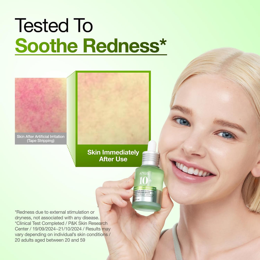 Anua Azelaic Acid 10 Hyaluron Redness Soothing Serum. 1.01 fl oz | Facial Serum for Blemish-Prone & Oily-Prone Skin. Lightweight & Hydrating Blemish Care. Hyaluronic Acid. Korean Skincare