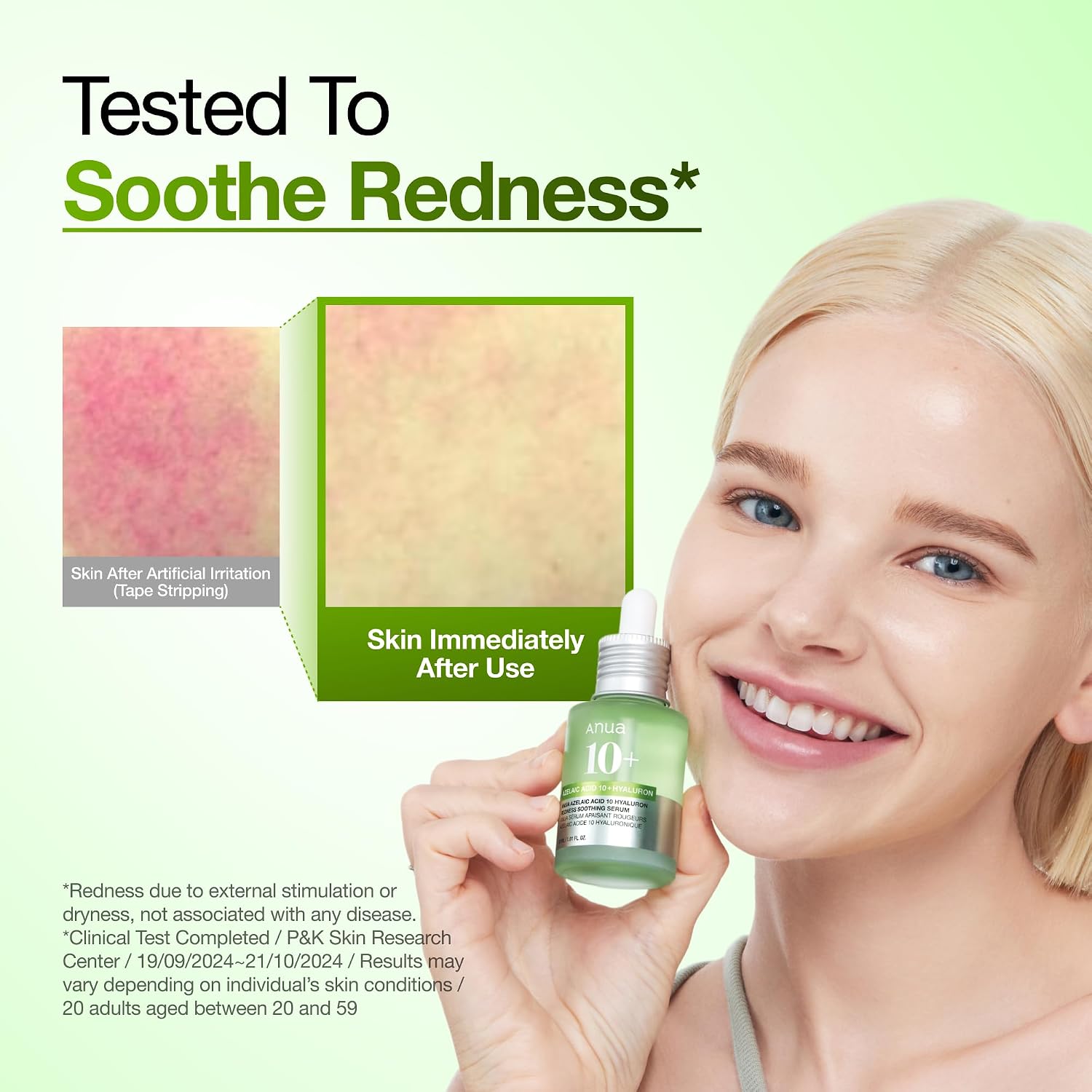 Anua Azelaic Acid 10 Hyaluron Redness Soothing Serum. 1.01 fl oz | Facial Serum for Blemish-Prone & Oily-Prone Skin. Lightweight & Hydrating Blemish Care. Hyaluronic Acid. Korean Skincare