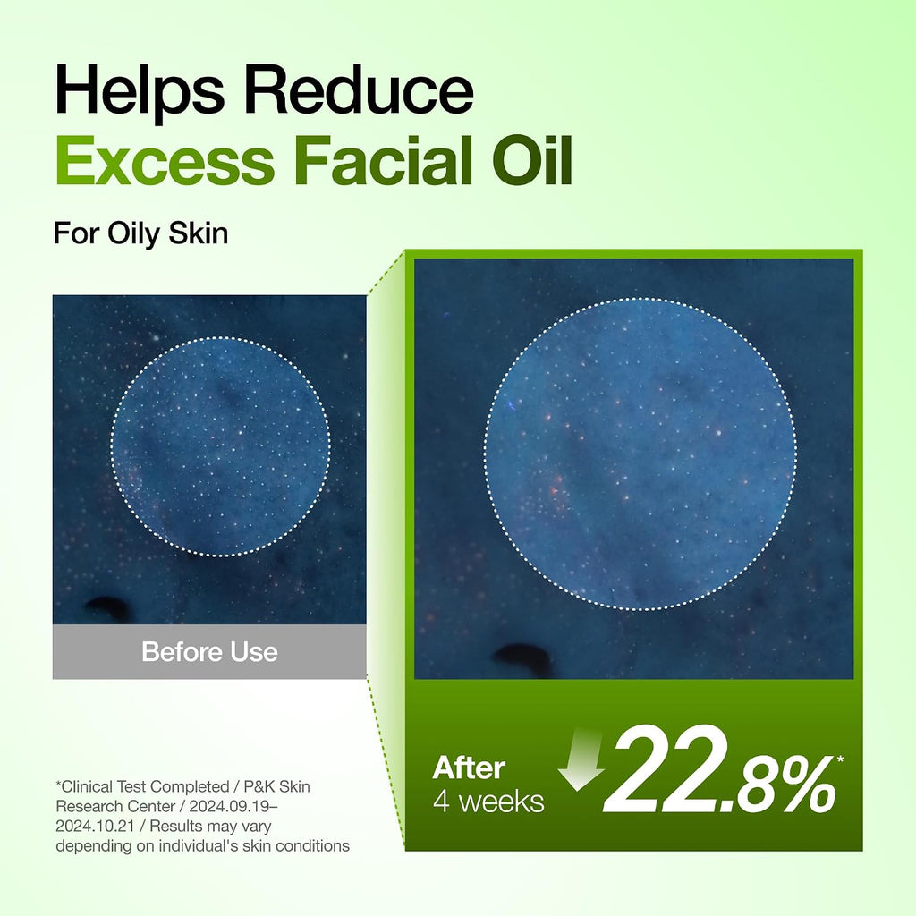 Anua Azelaic Acid 10 Hyaluron Redness Soothing Serum. 1.01 fl oz | Facial Serum for Blemish-Prone & Oily-Prone Skin. Lightweight & Hydrating Blemish Care. Hyaluronic Acid. Korean Skincare