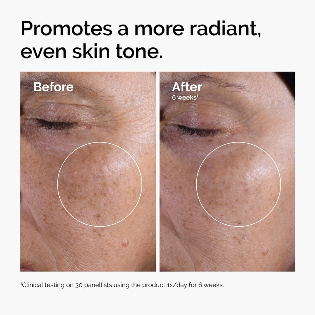 The Ordinary Glycolic Acid 7% Exfoliating Toner. Brightening and Smoothing Daily Toner for More Even-Looking Skin Tone. 8.1 Fl Oz