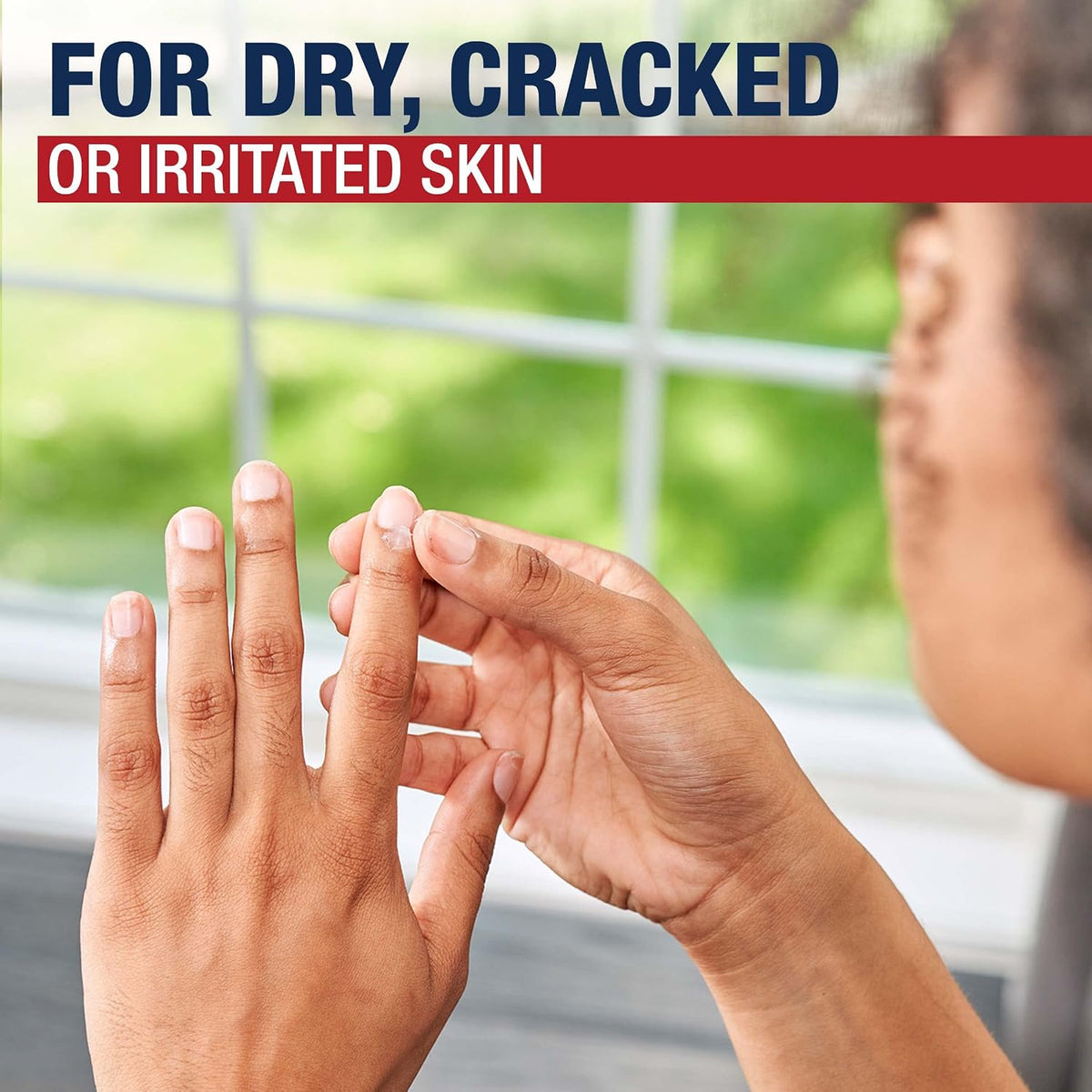 Aquaphor Advanced Therapy Healing Ointment. Skin Protectant. 7 OZ | Clinically Proven Skin Protectant Moisturizer for Cracked. Irritated or Dry Skin Relief. Dye and Fragrance Free