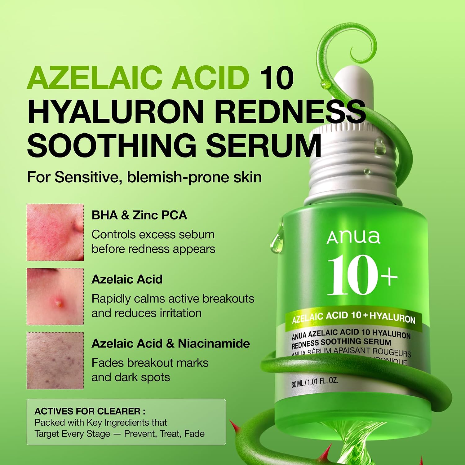 Anua Azelaic Acid 10 Hyaluron Redness Soothing Serum. 1.01 fl oz | Facial Serum for Blemish-Prone & Oily-Prone Skin. Lightweight & Hydrating Blemish Care. Hyaluronic Acid. Korean Skincare